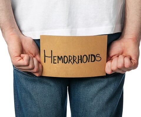 Hemorrhoids or piles problem illustration for Piles Treatment in Jabalpur by Best Piles Doctor in Jabalpur